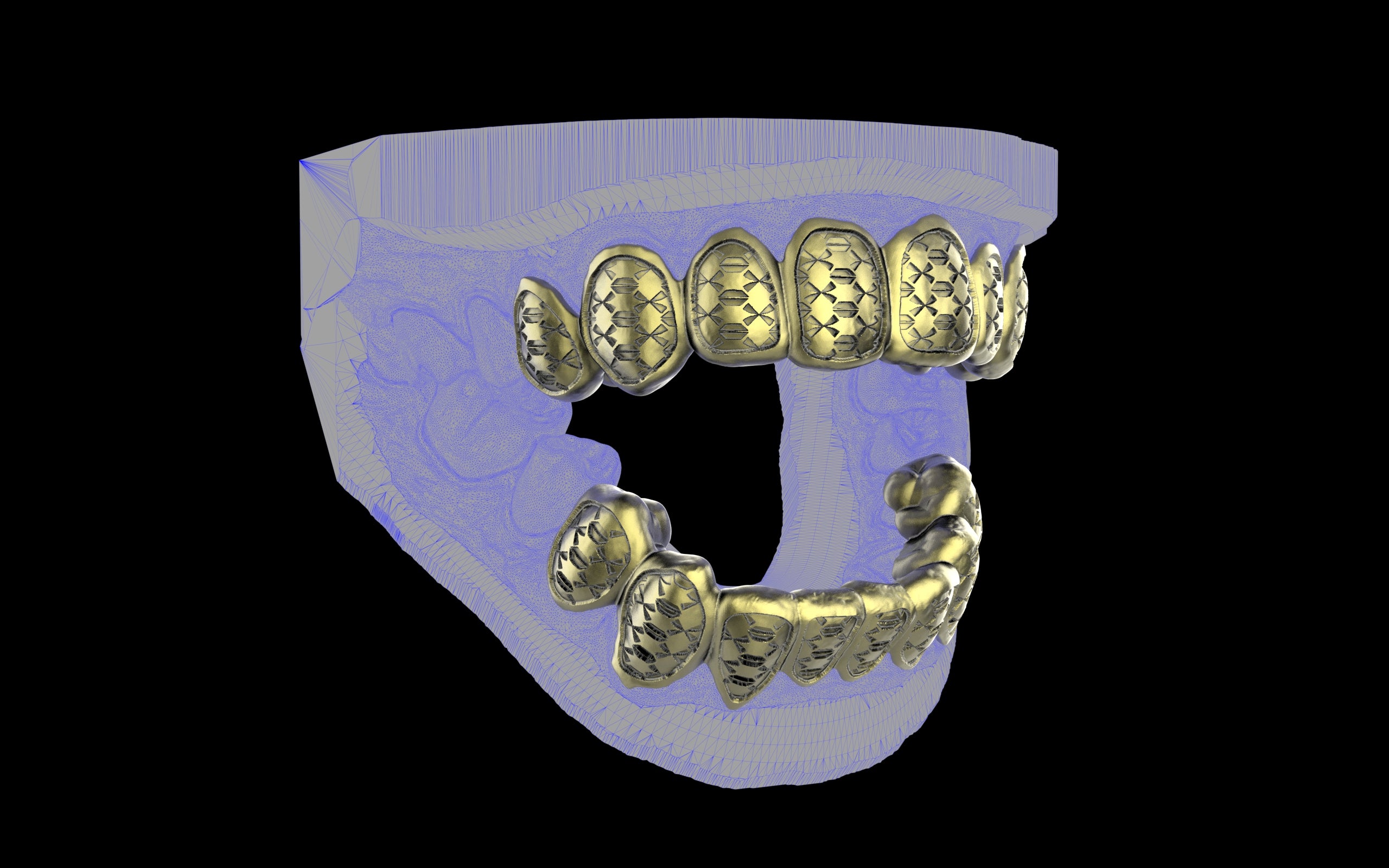 Custom Grillz / Tooth Caps - Funktion One