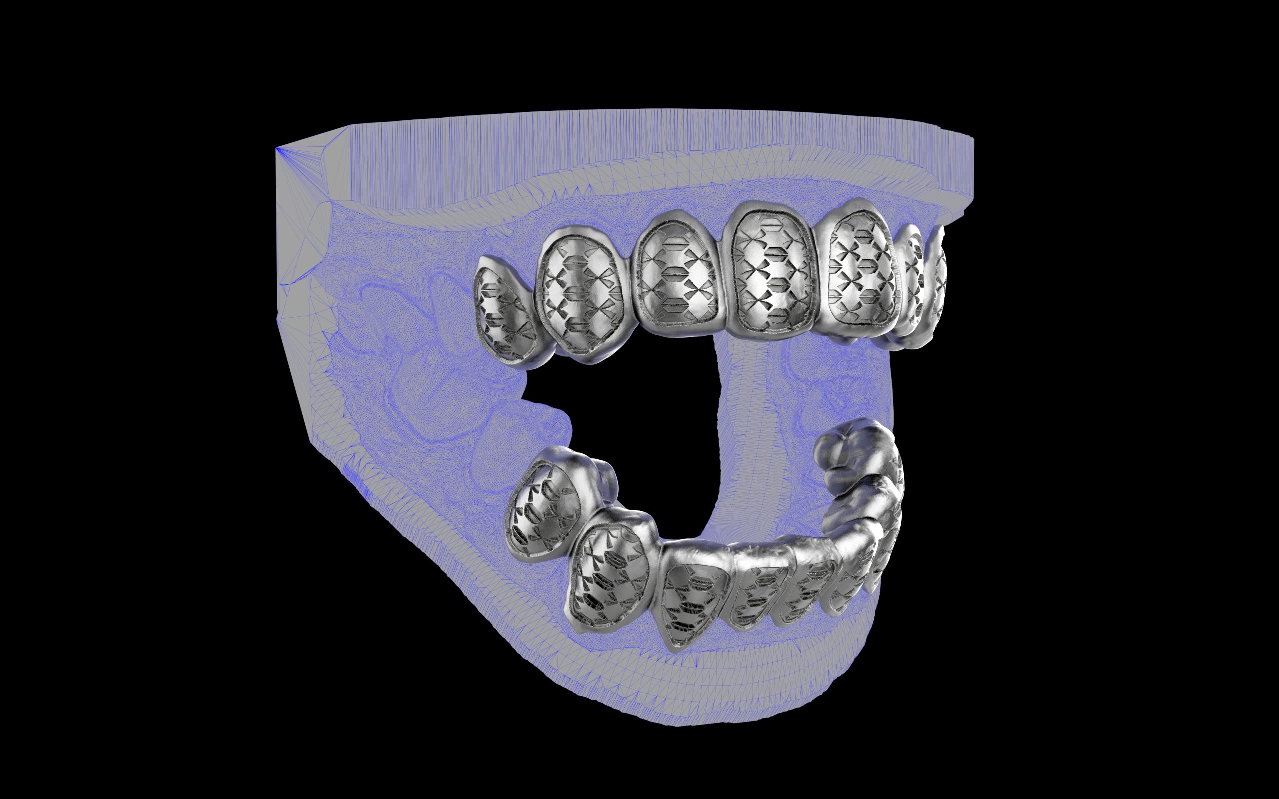 Custom Grillz / Tooth Caps - Funktion One