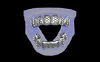 Custom Grillz / Tooth Caps - Funktion One
