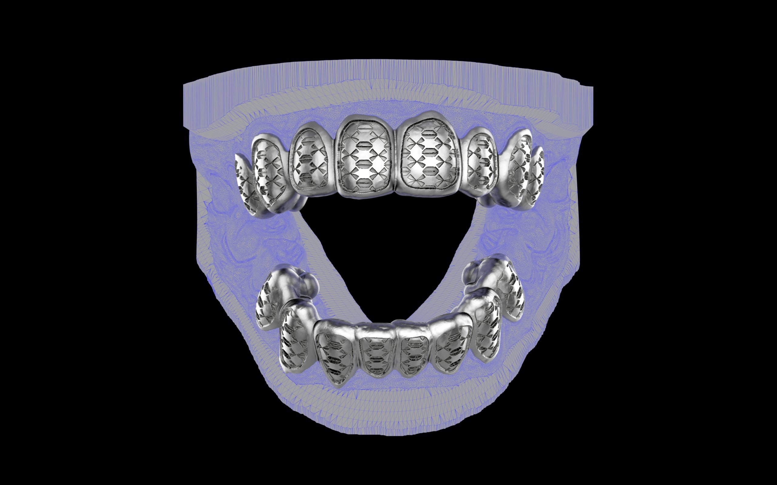 Custom Grillz / Tooth Caps - Funktion One