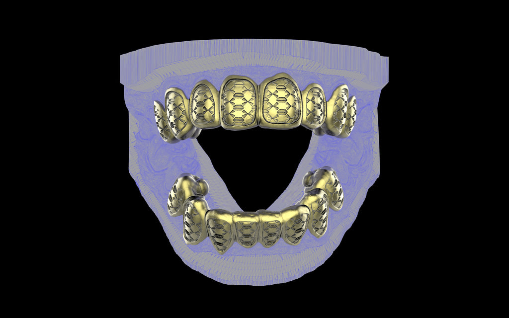 Custom Grillz / Tooth Caps - Funktion One