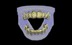 Custom Grillz / Tooth Caps - Funktion One