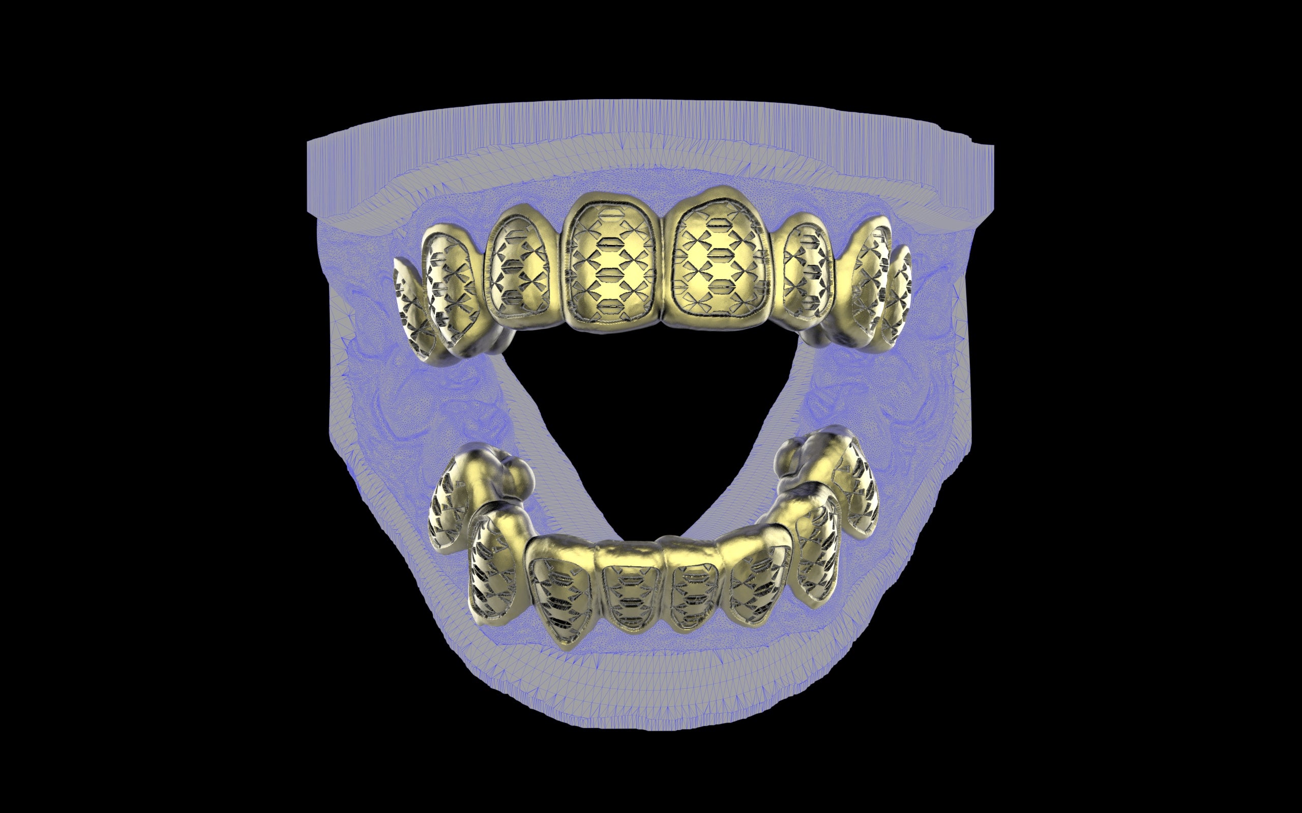 Custom Grillz / Tooth Caps - Funktion One