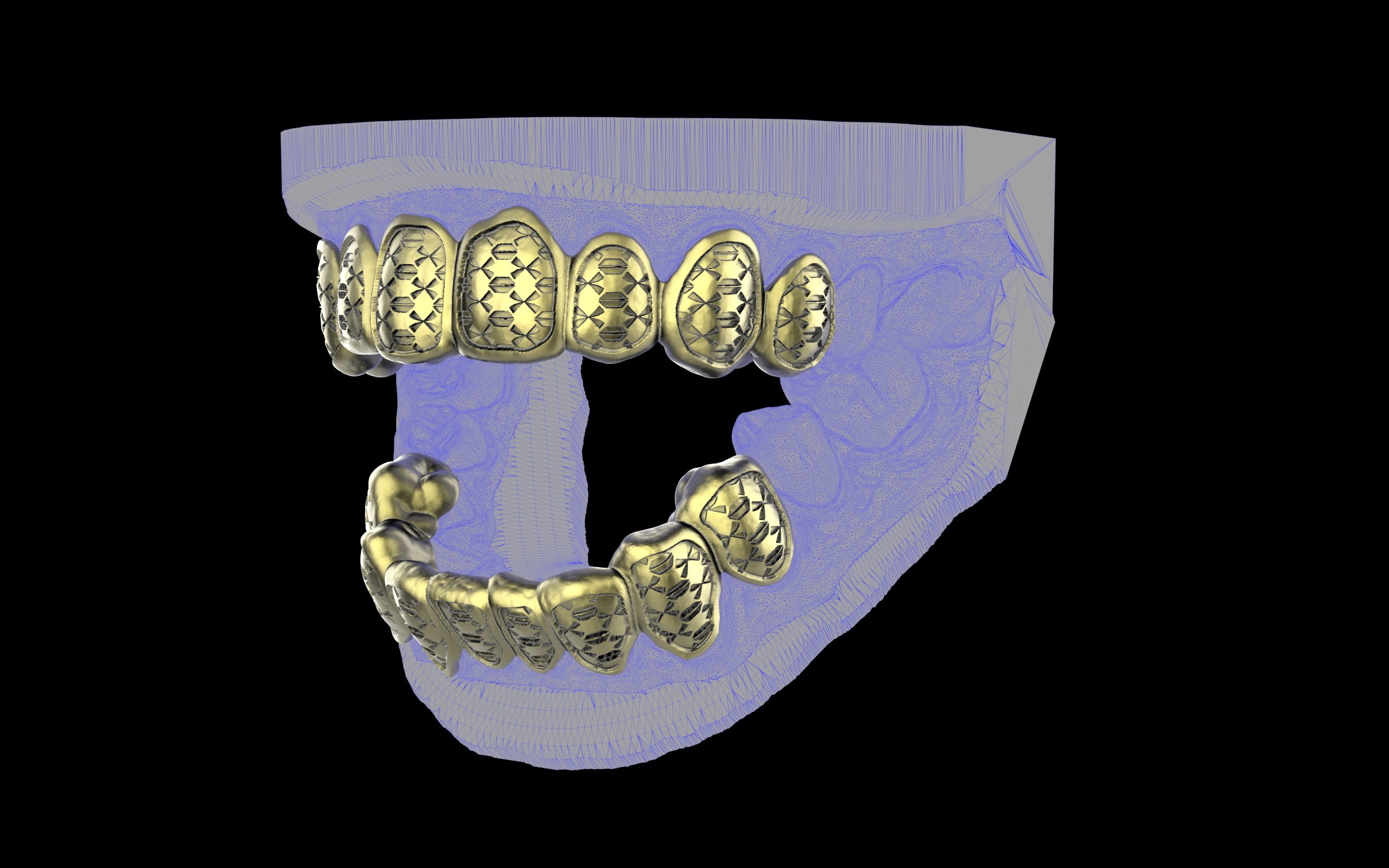 Custom Grillz / Tooth Caps - Funktion One