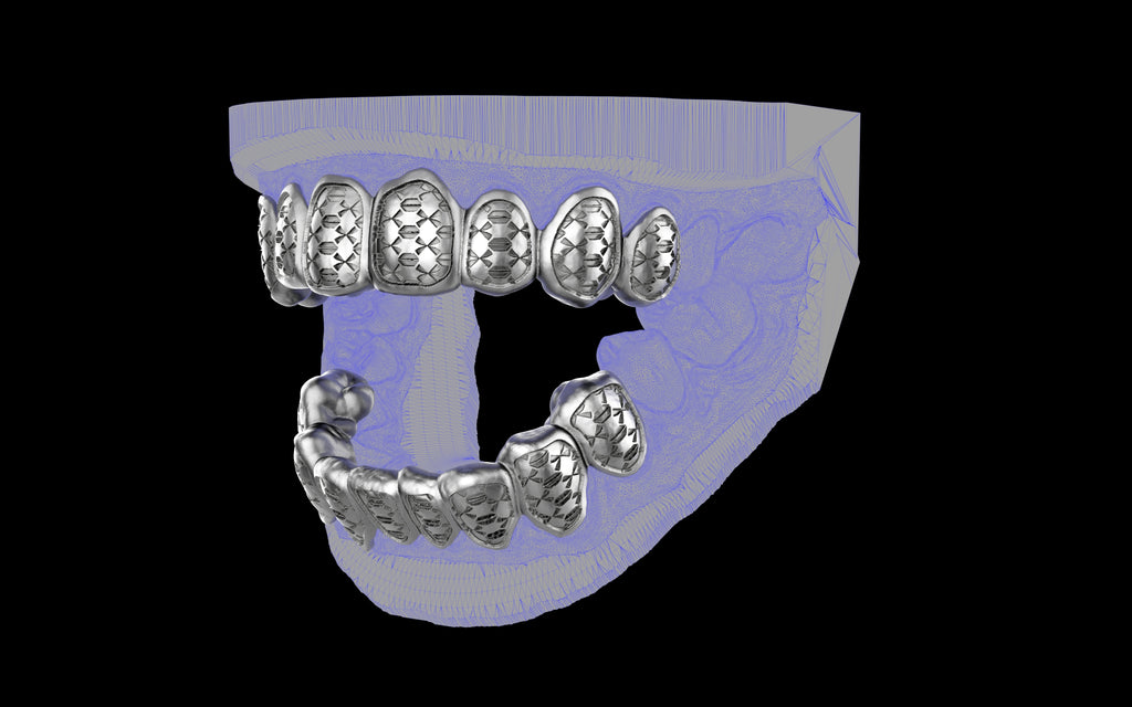 Custom Grillz / Tooth Caps - Funktion One