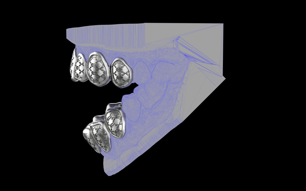 Custom Grillz / Tooth Caps - Funktion One