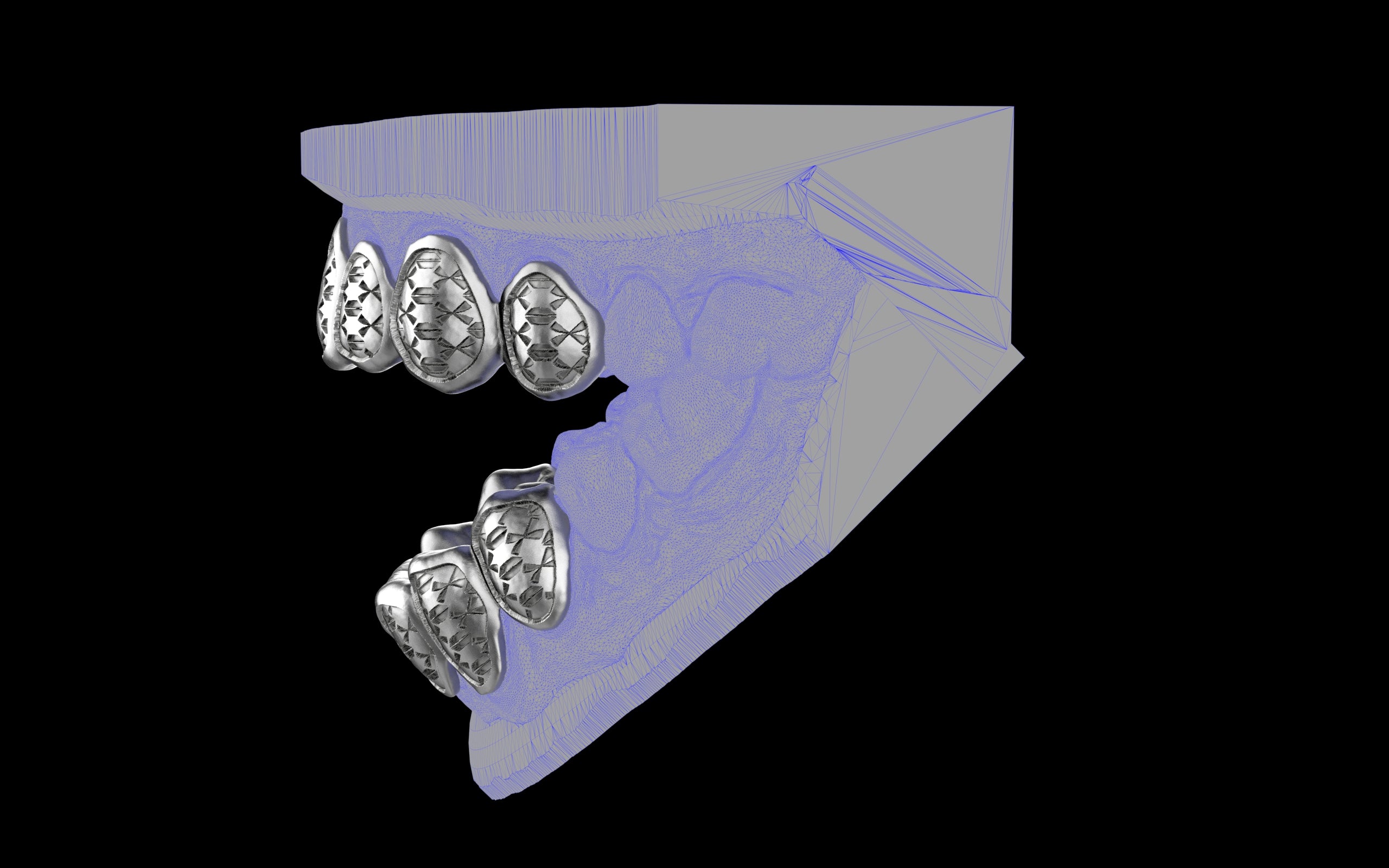 Custom Grillz / Tooth Caps - Funktion One