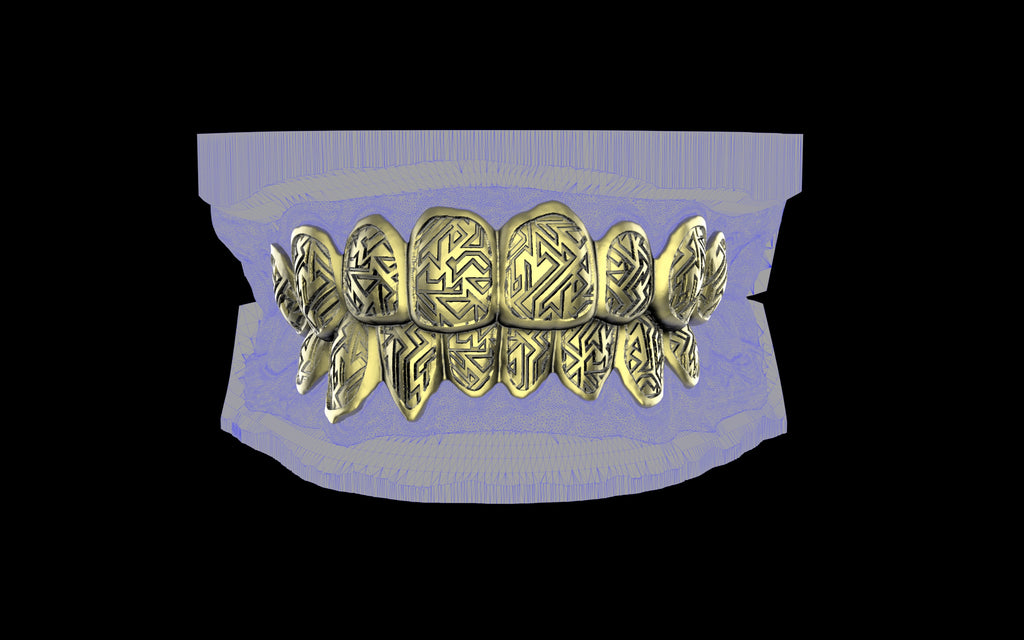 Custom Grillz / Tooth Caps - Graffiti Cut