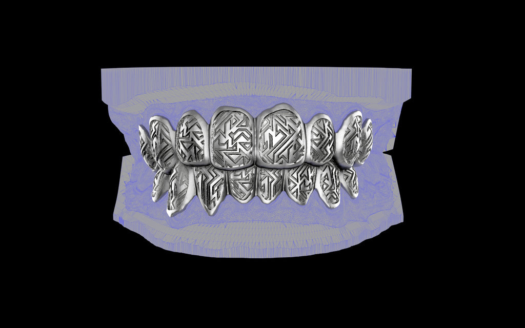 Custom Grillz / Tooth Caps - Graffiti Cut