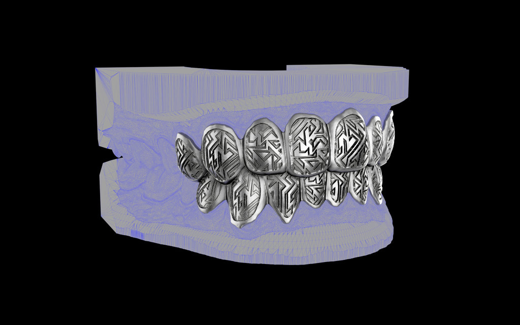 Custom Grillz / Tooth Caps - Graffiti Cut