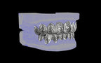Custom Grillz / Tooth Caps - Graffiti Cut