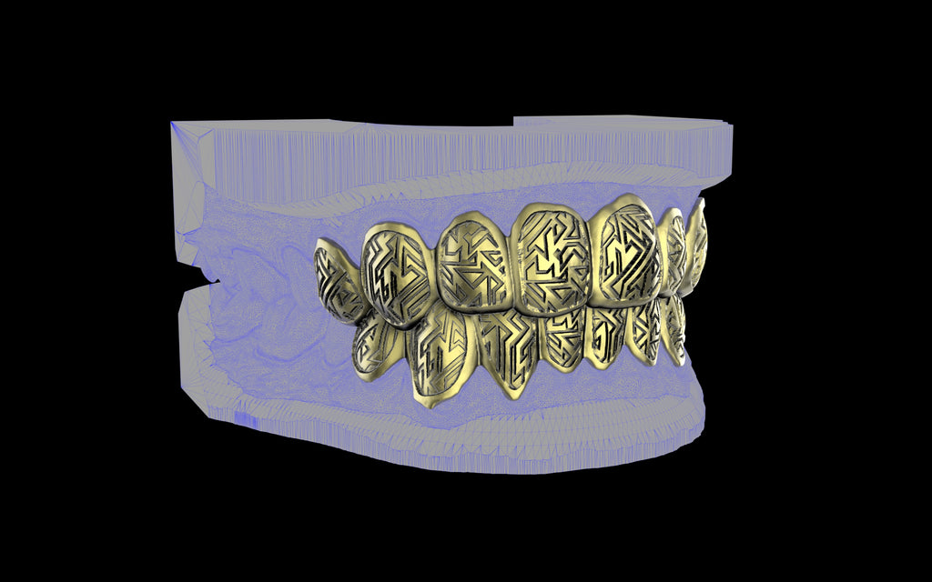 Custom Grillz / Tooth Caps - Graffiti Cut