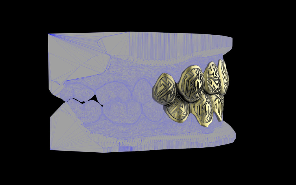 Custom Grillz / Tooth Caps - Graffiti Cut