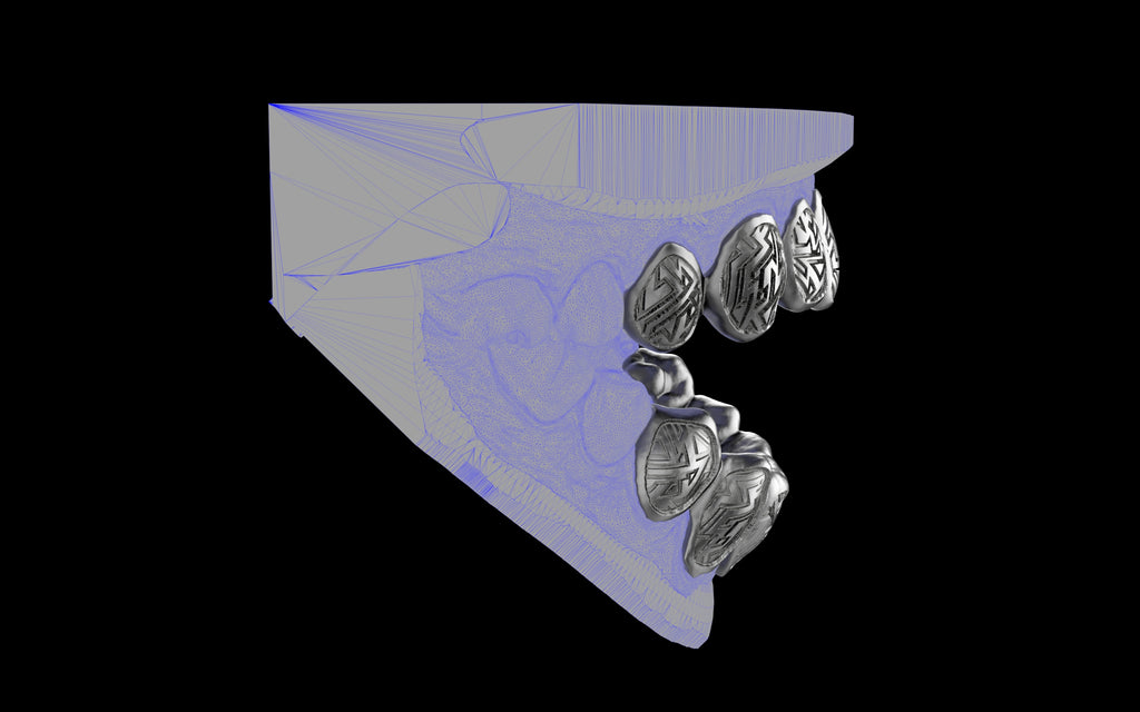 Custom Grillz / Tooth Caps - Graffiti Cut