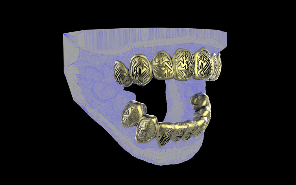 Custom Grillz / Tooth Caps - Graffiti Cut