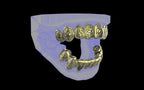 Custom Grillz / Tooth Caps - Graffiti Cut