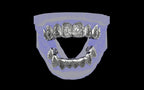Custom Grillz / Tooth Caps - Graffiti Cut