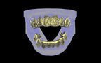 Custom Grillz / Tooth Caps - Graffiti Cut