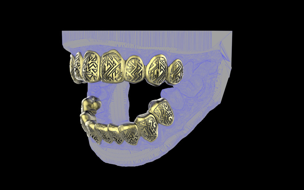 Custom Grillz / Tooth Caps - Graffiti Cut