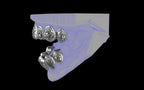 Custom Grillz / Tooth Caps - Graffiti Cut