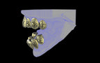 Custom Grillz / Tooth Caps - Graffiti Cut