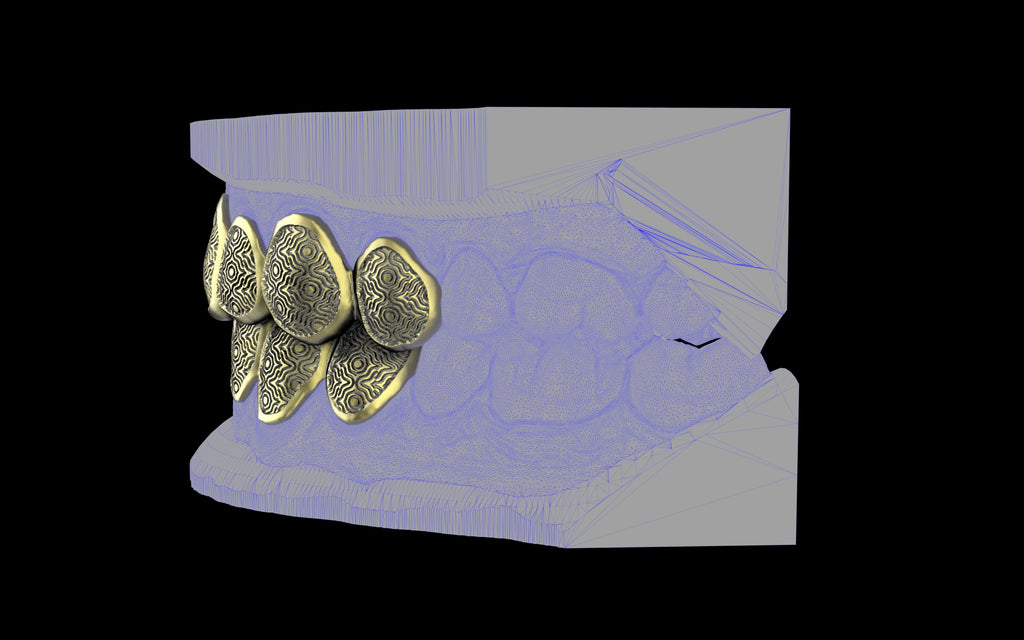 Custom Grillz / Tooth Caps - Puddled Cut