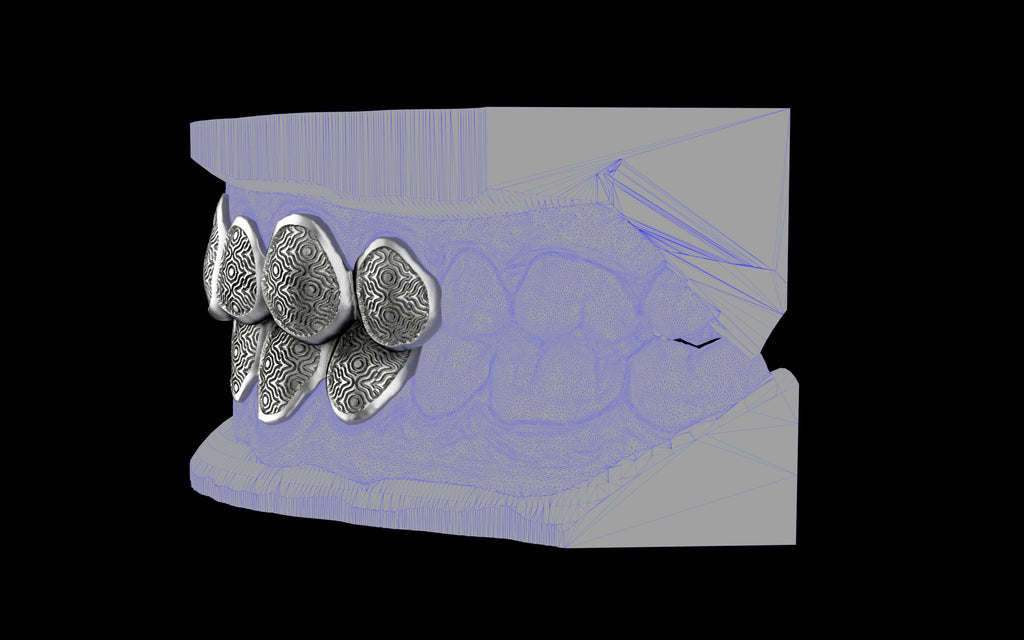 Custom Grillz / Tooth Caps - Puddled Cut