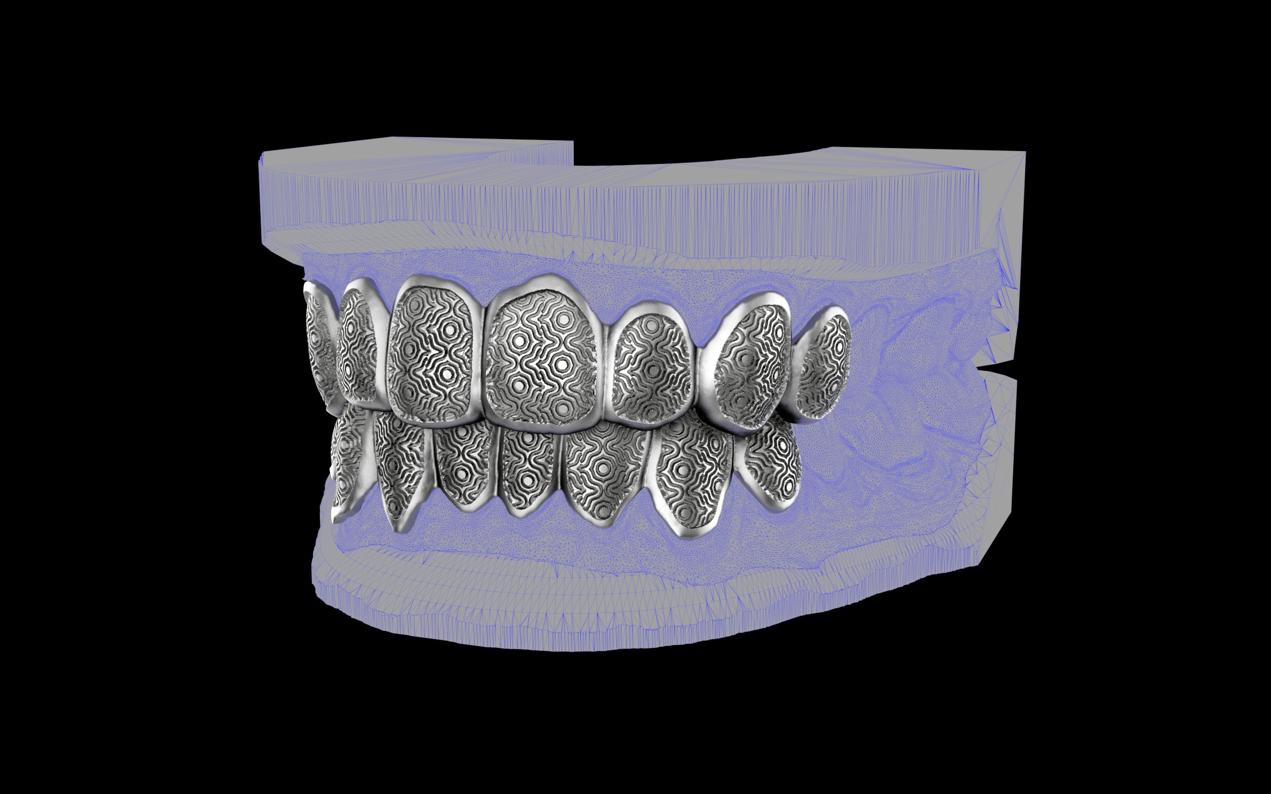 Custom Grillz / Tooth Caps - Puddled Cut