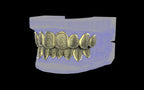 Custom Grillz / Tooth Caps - Puddled Cut