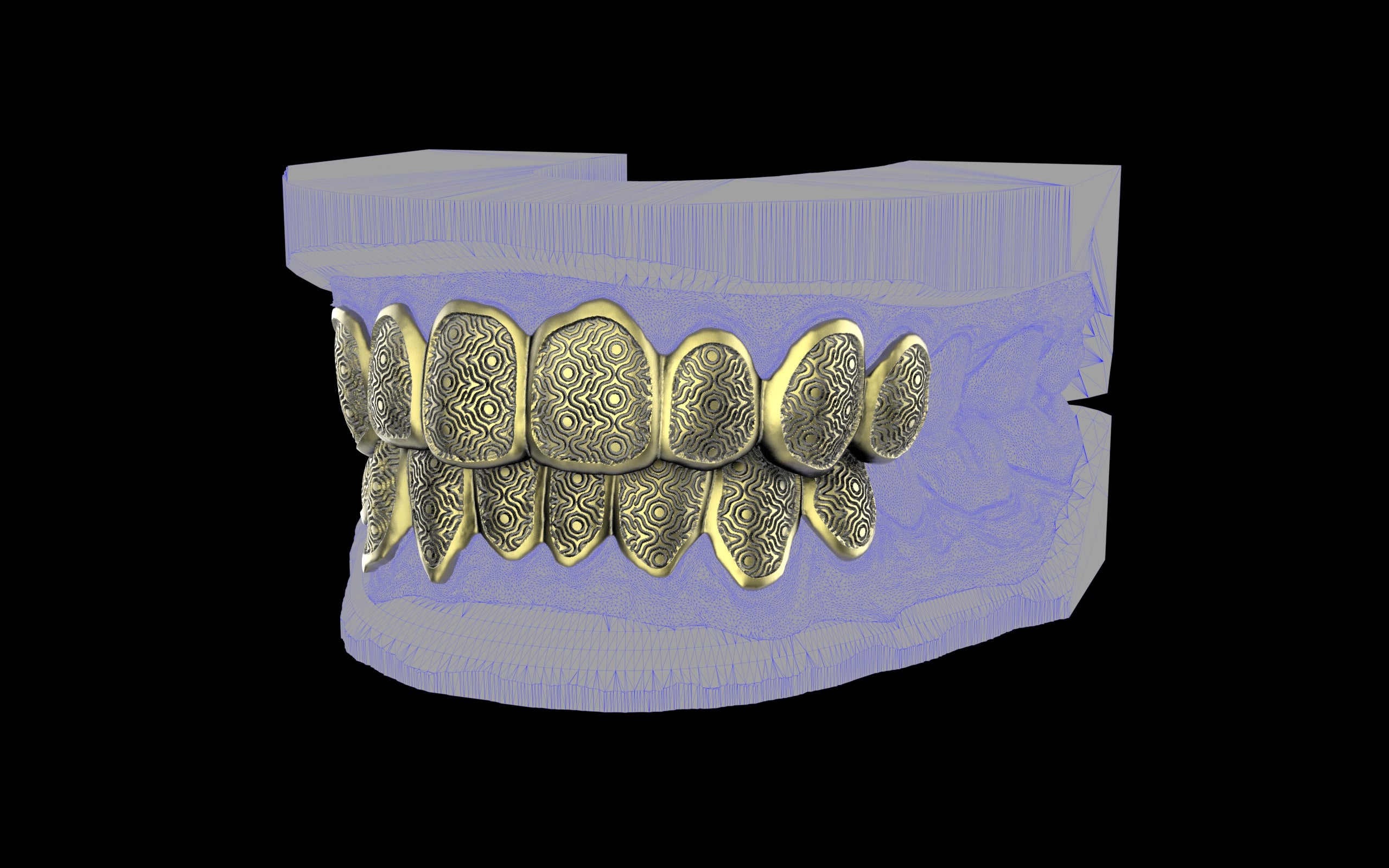 Custom Grillz / Tooth Caps - Puddled Cut