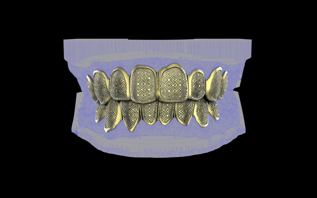 Custom Grillz / Tooth Caps - Puddled Cut