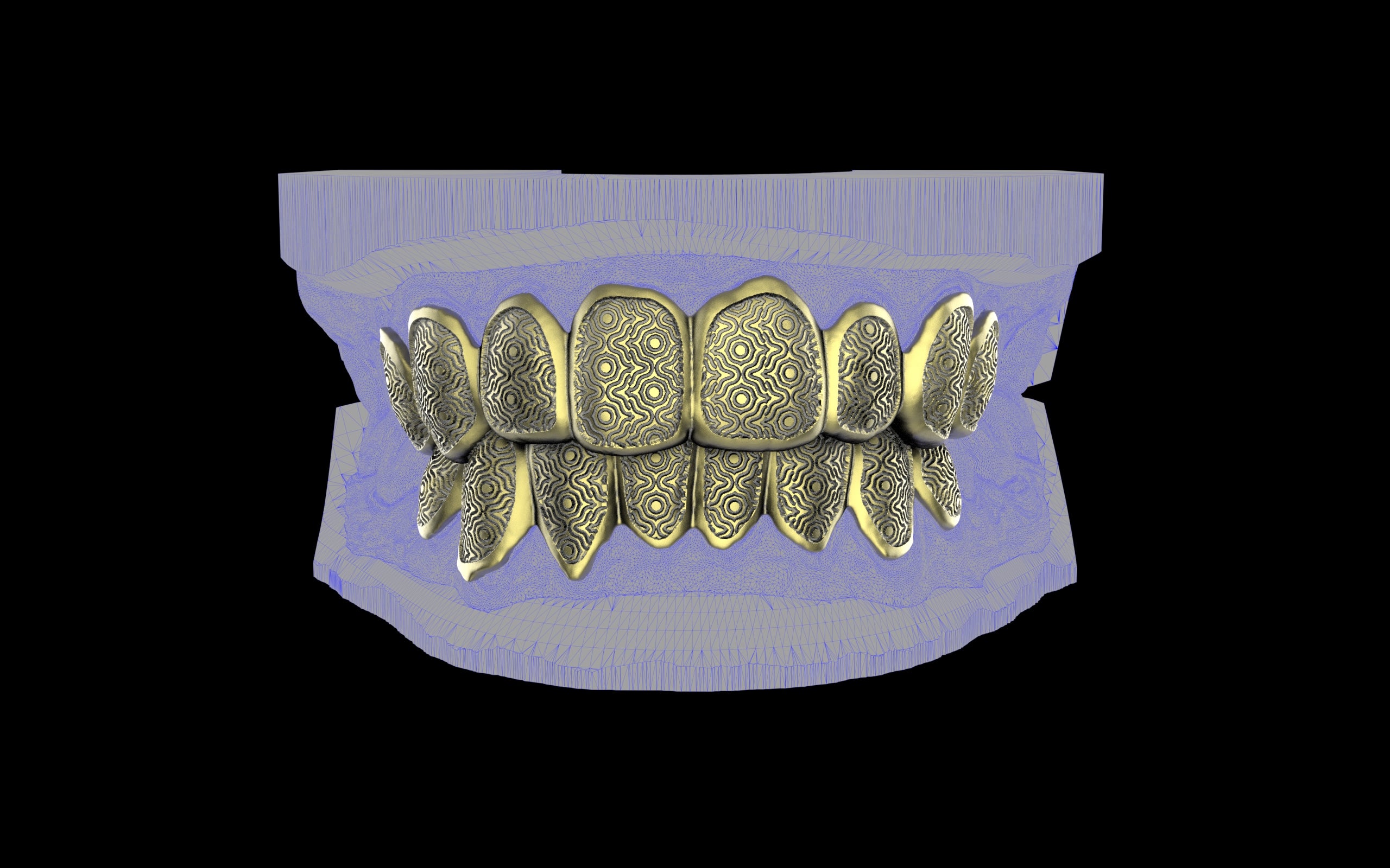 Custom Grillz / Tooth Caps - Puddled Cut