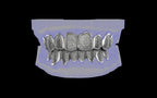 Custom Grillz / Tooth Caps - Puddled Cut