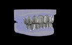 Custom Grillz / Tooth Caps - Puddled Cut