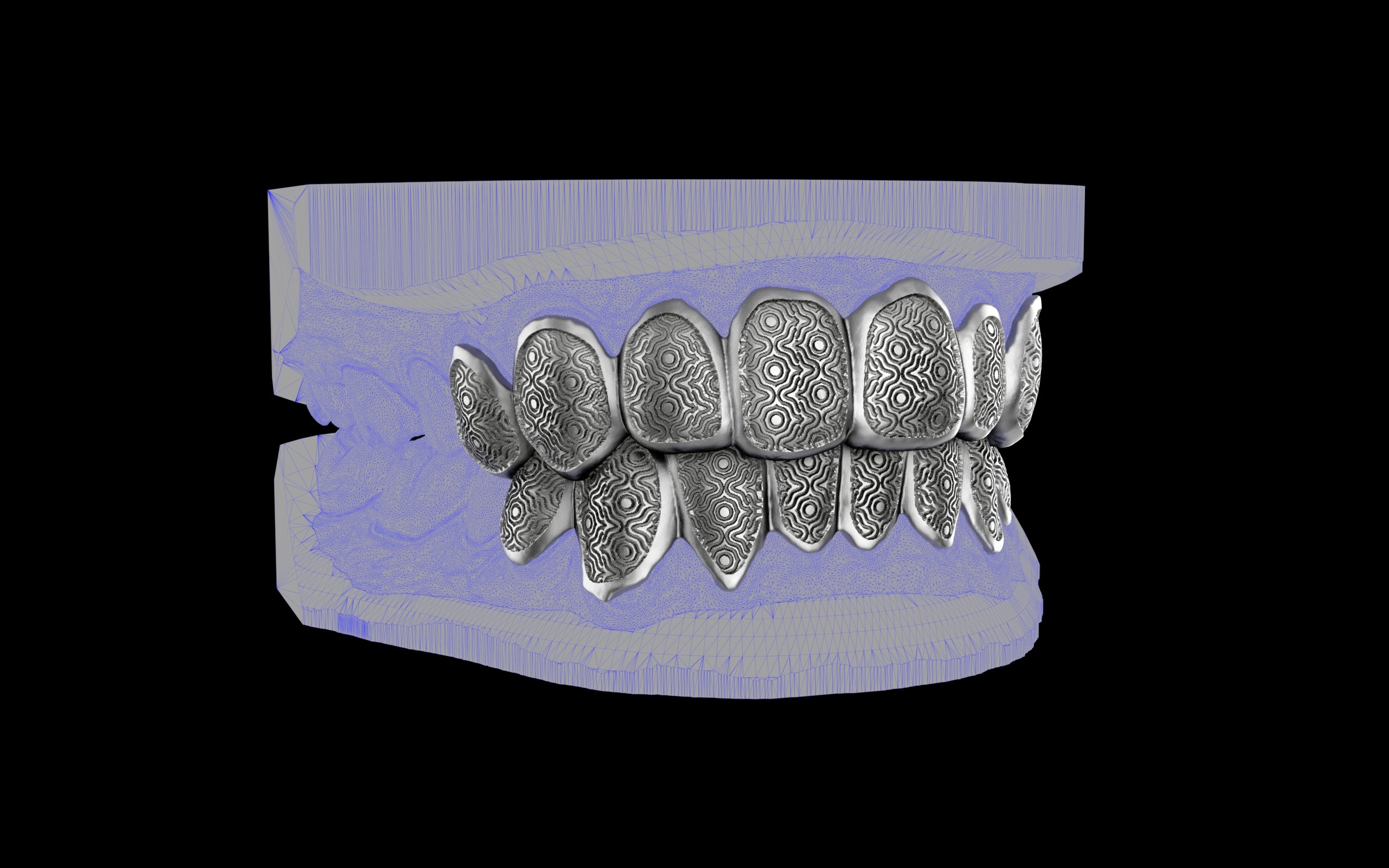 Custom Grillz / Tooth Caps - Puddled Cut