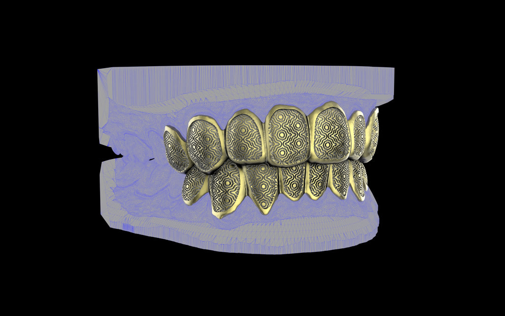 Custom Grillz / Tooth Caps - Puddled Cut