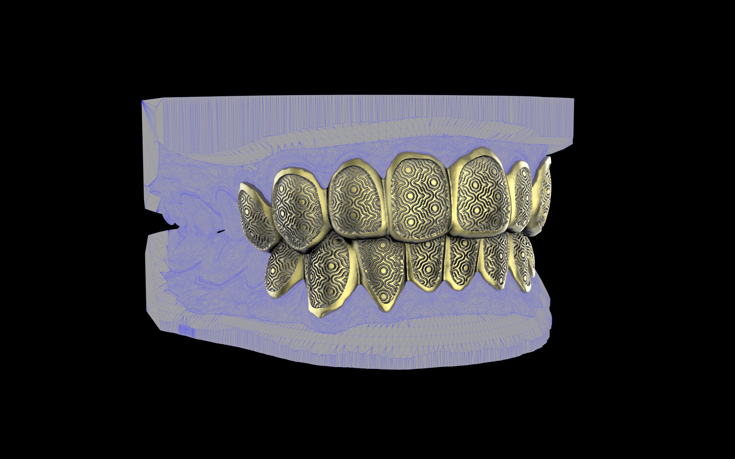 Custom Grillz / Tooth Caps - Puddled Cut