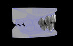 Custom Grillz / Tooth Caps - Puddled Cut