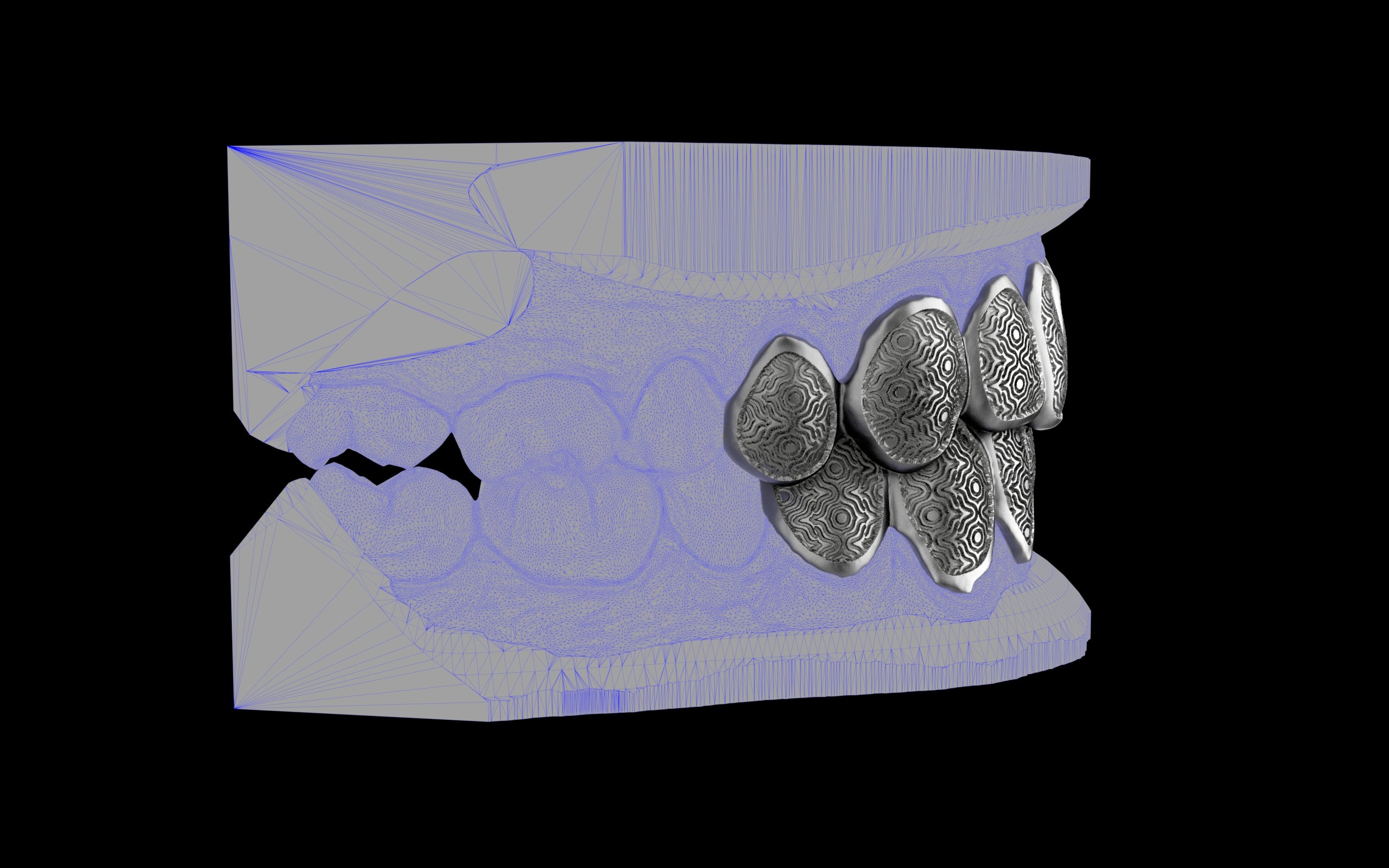 Custom Grillz / Tooth Caps - Puddled Cut