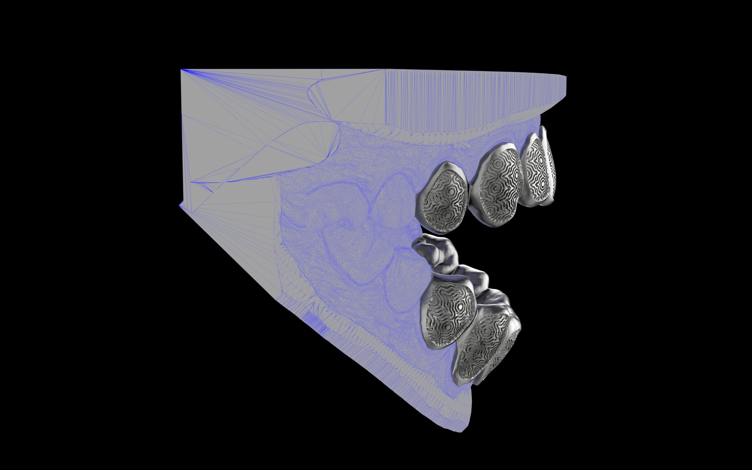Custom Grillz / Tooth Caps - Puddled Cut