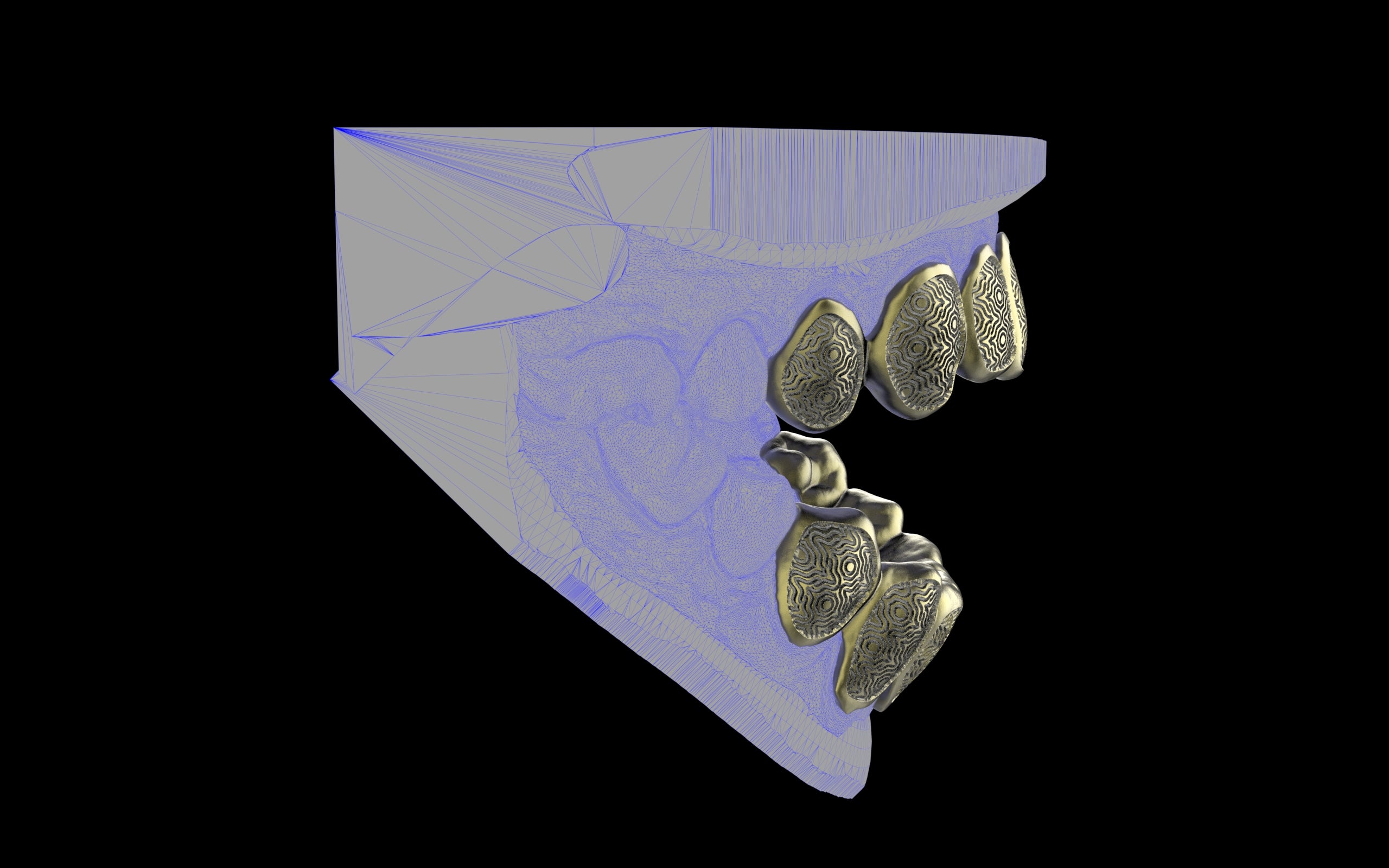 Custom Grillz / Tooth Caps - Puddled Cut