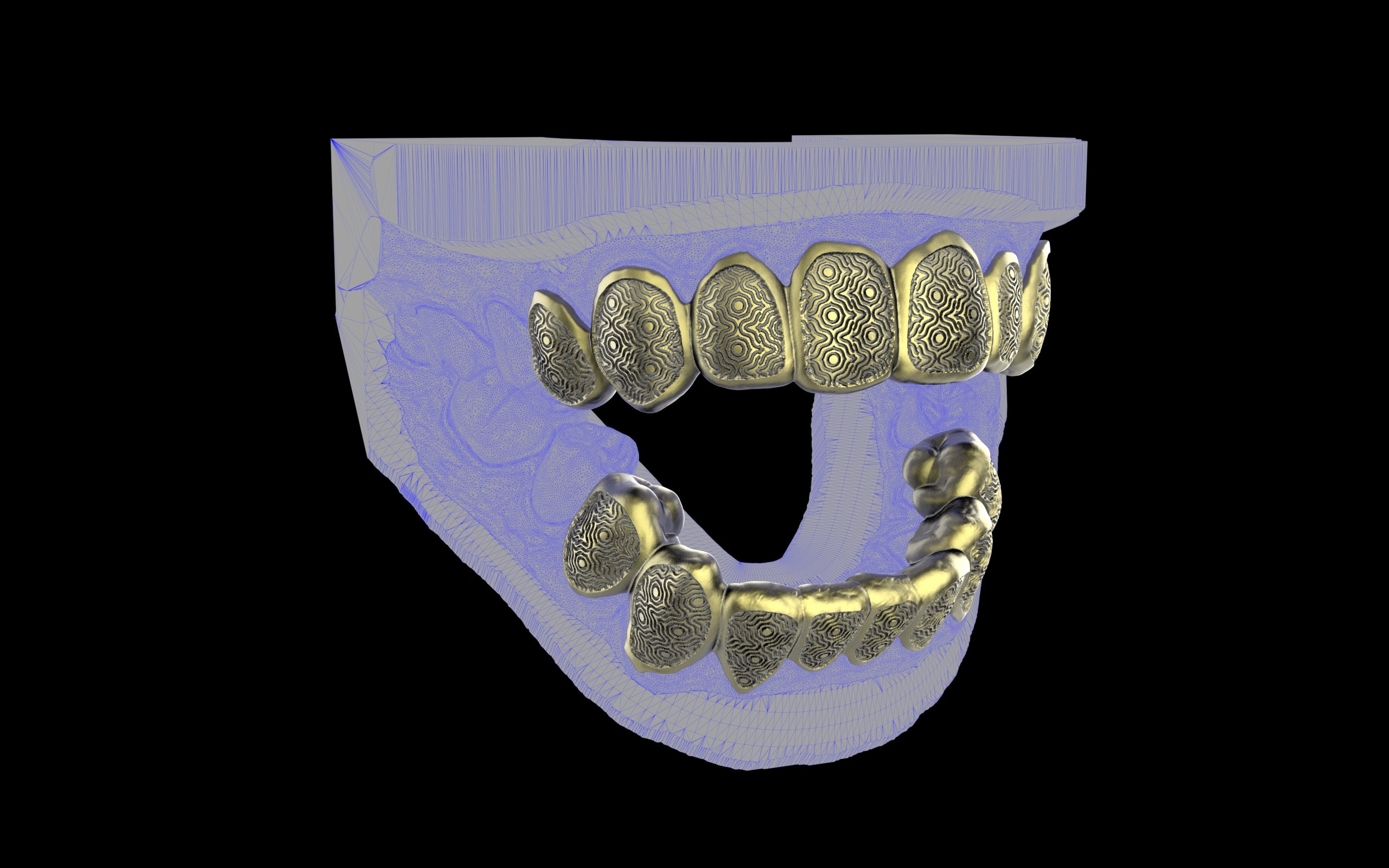 Custom Grillz / Tooth Caps - Puddled Cut