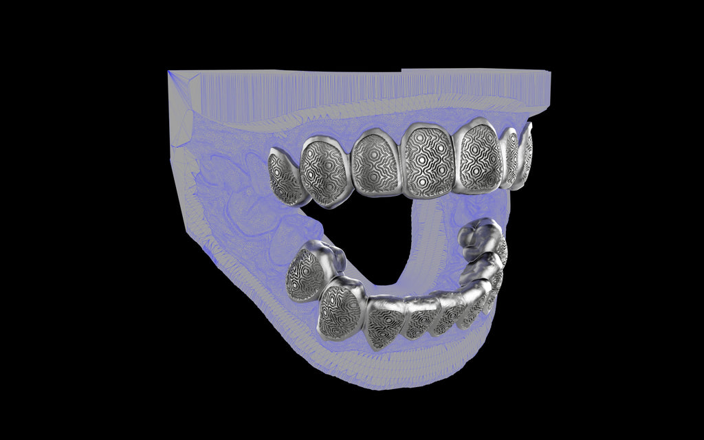 Custom Grillz / Tooth Caps - Puddled Cut