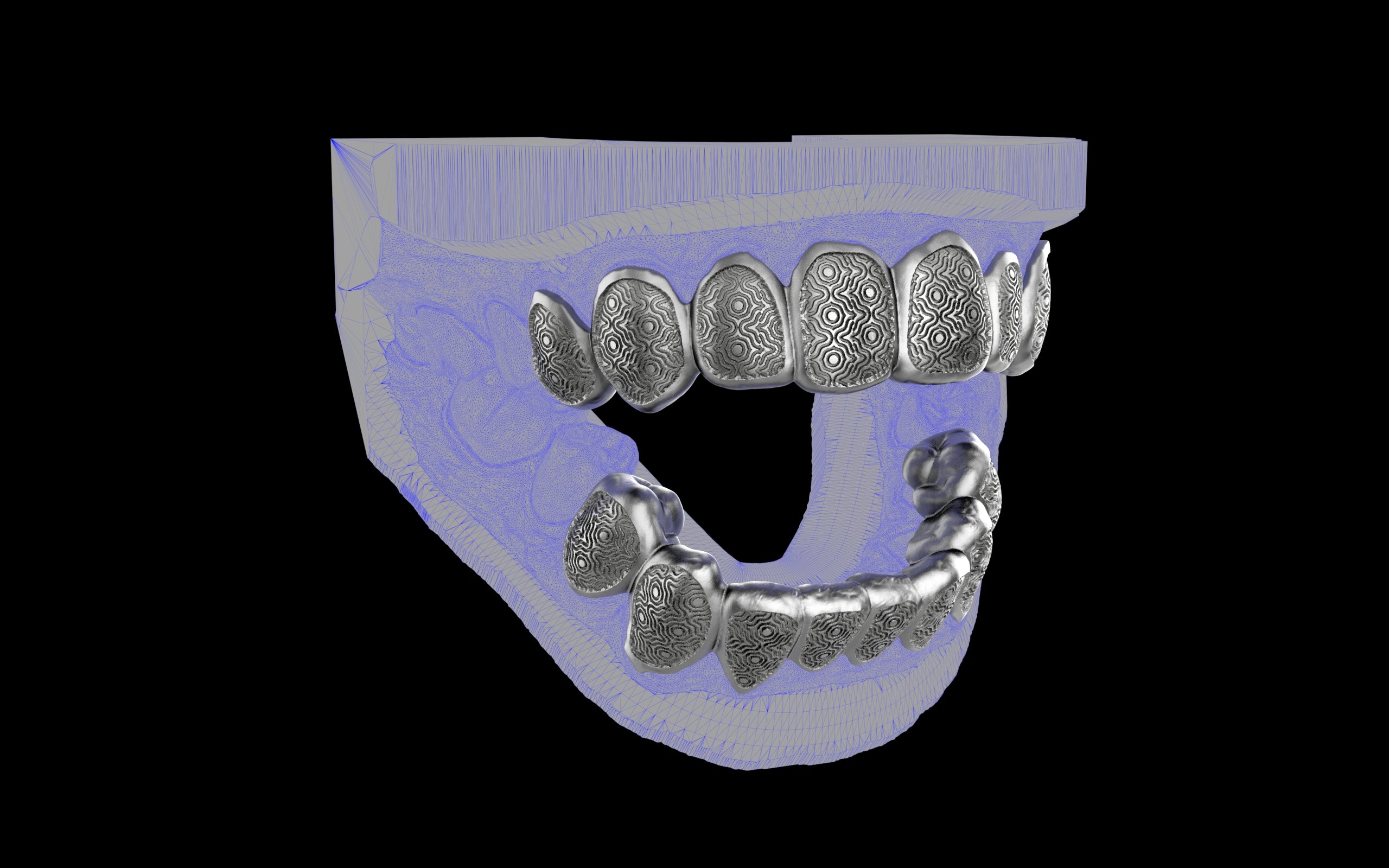 Custom Grillz / Tooth Caps - Puddled Cut