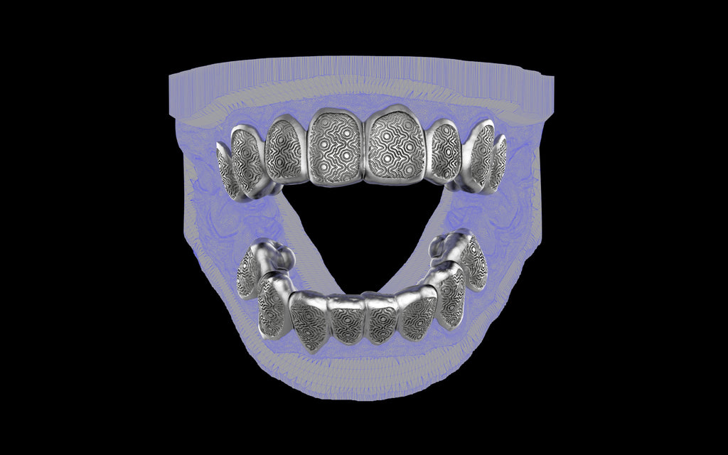 Custom Grillz / Tooth Caps - Puddled Cut