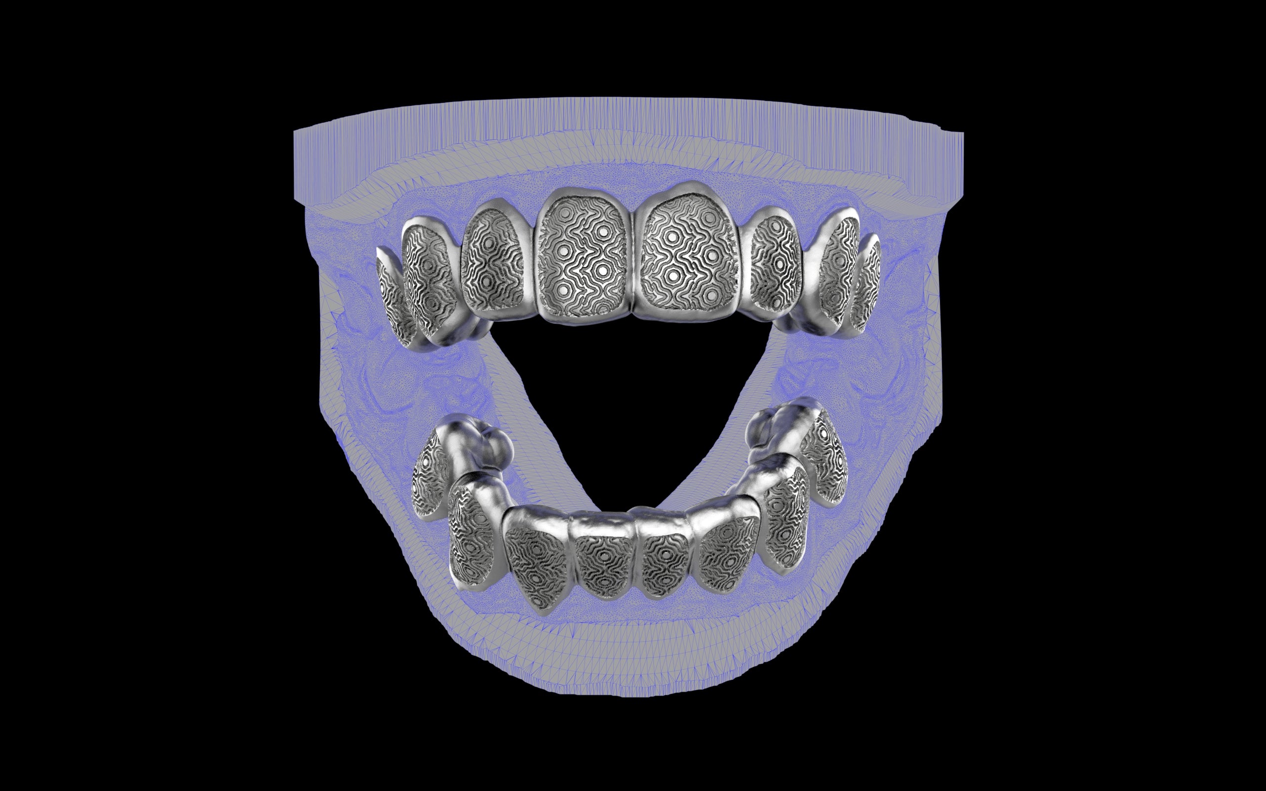 Custom Grillz / Tooth Caps - Puddled Cut