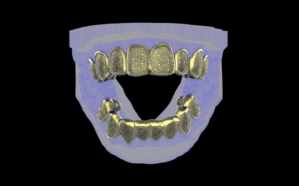 Custom Grillz / Tooth Caps - Puddled Cut