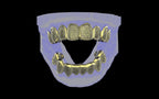 Custom Grillz / Tooth Caps - Puddled Cut
