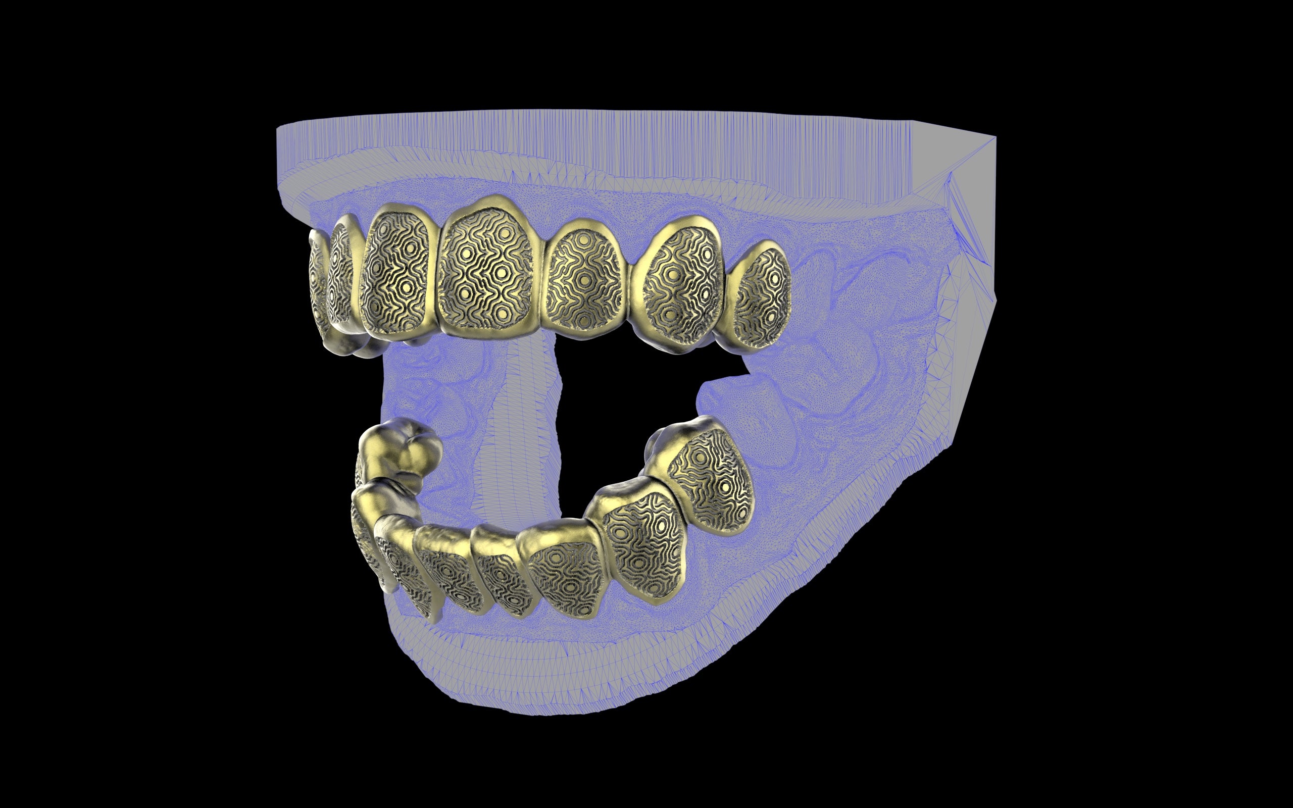 Custom Grillz / Tooth Caps - Puddled Cut