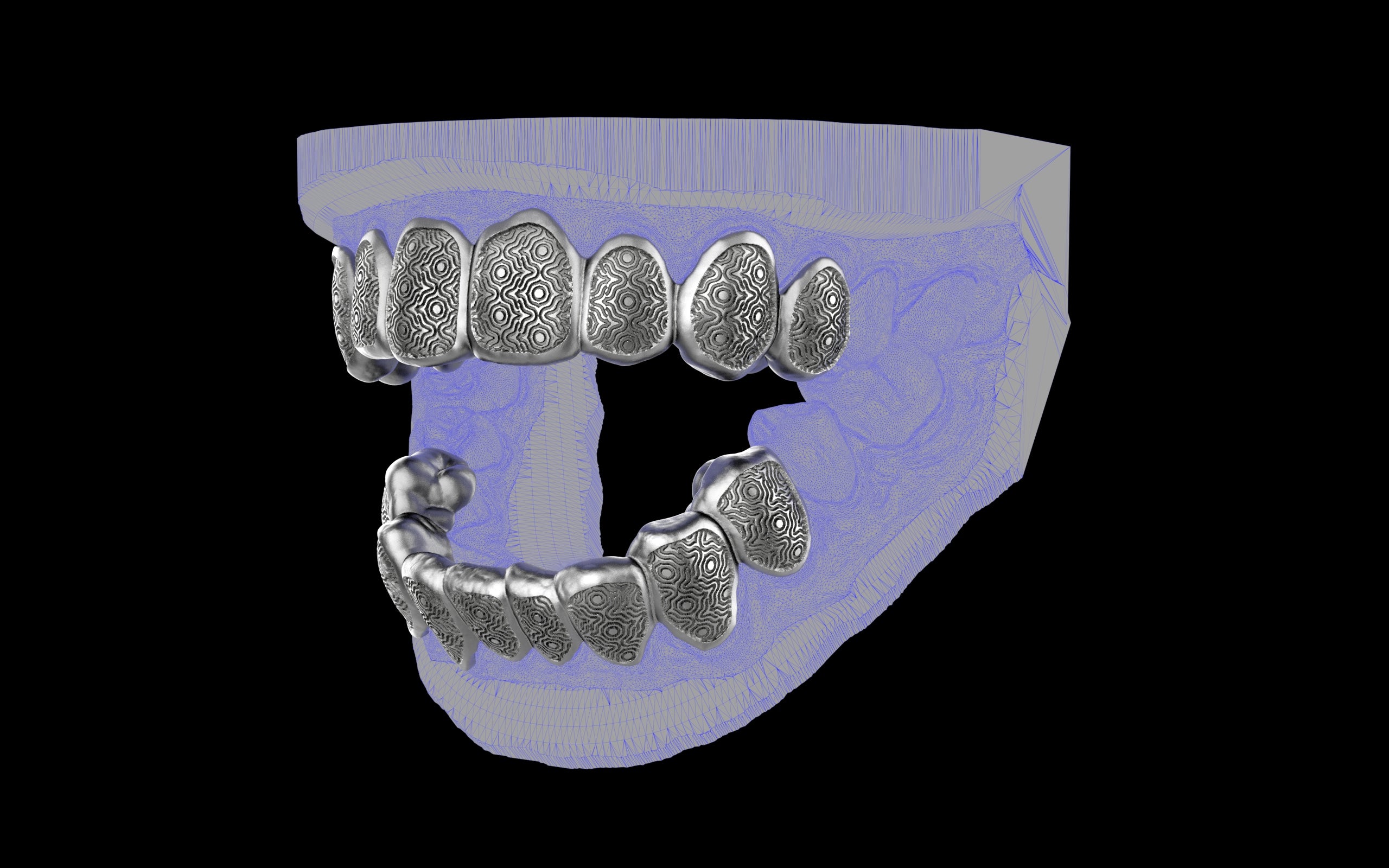 Custom Grillz / Tooth Caps - Puddled Cut